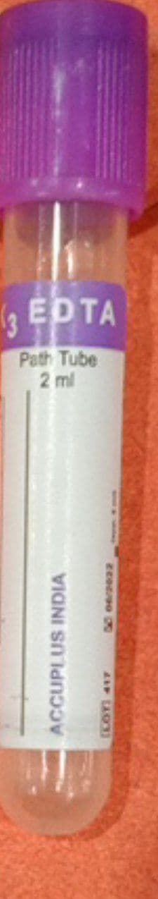 EDTA K3 ( PATHOLOGY )