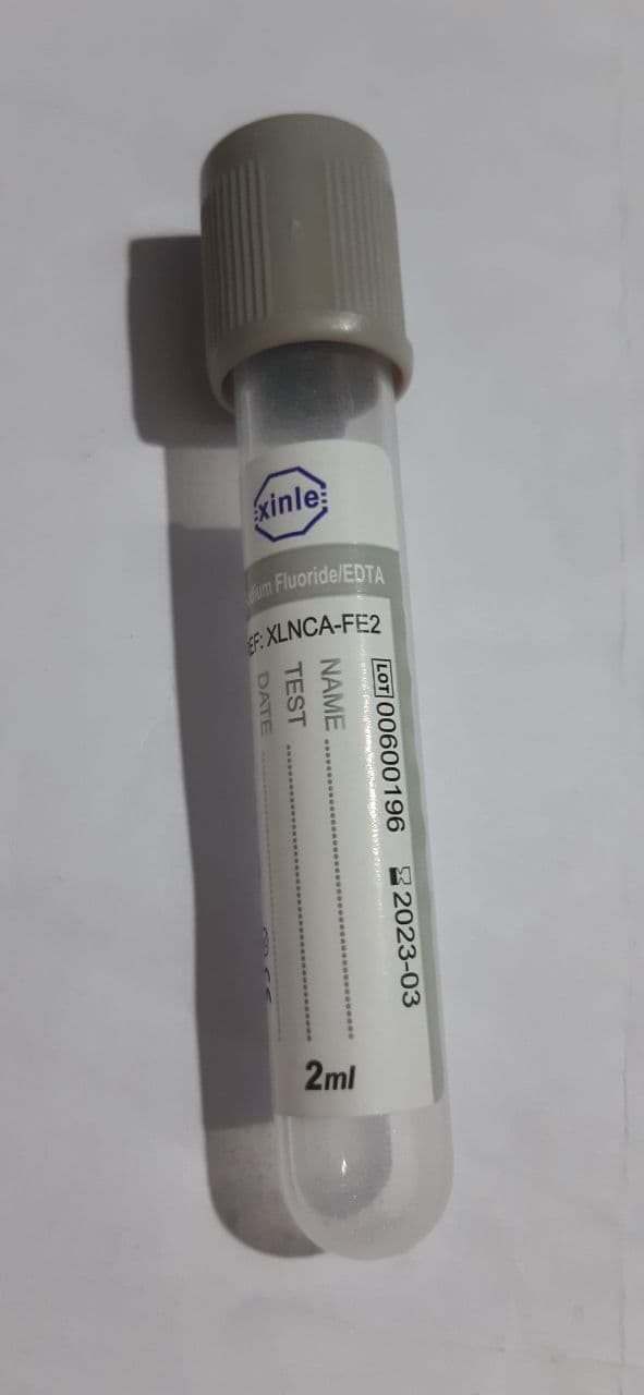 SODIUM FLUORIDE 2 ML ( PATHOLOGY )